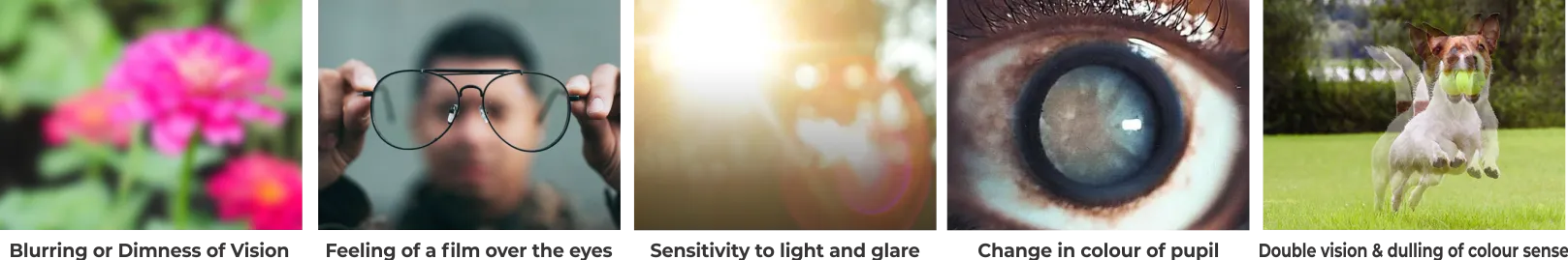 Different IOL Options