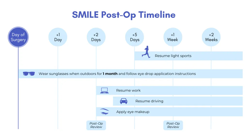 SMILE Pro Surgery Process Diagram