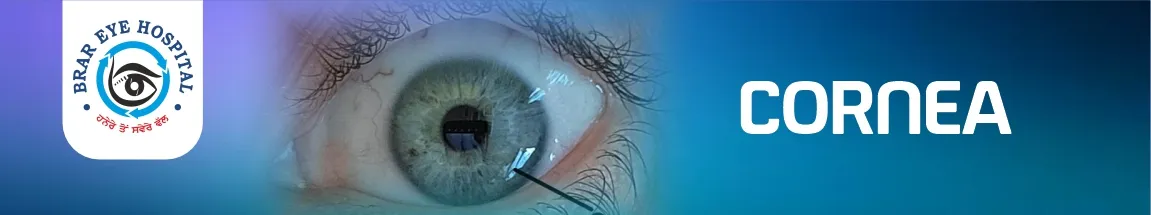 Cornea Services Banner