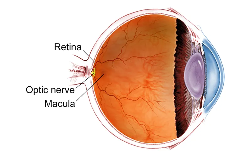 Best Eye Hospital for LASIK and Retina