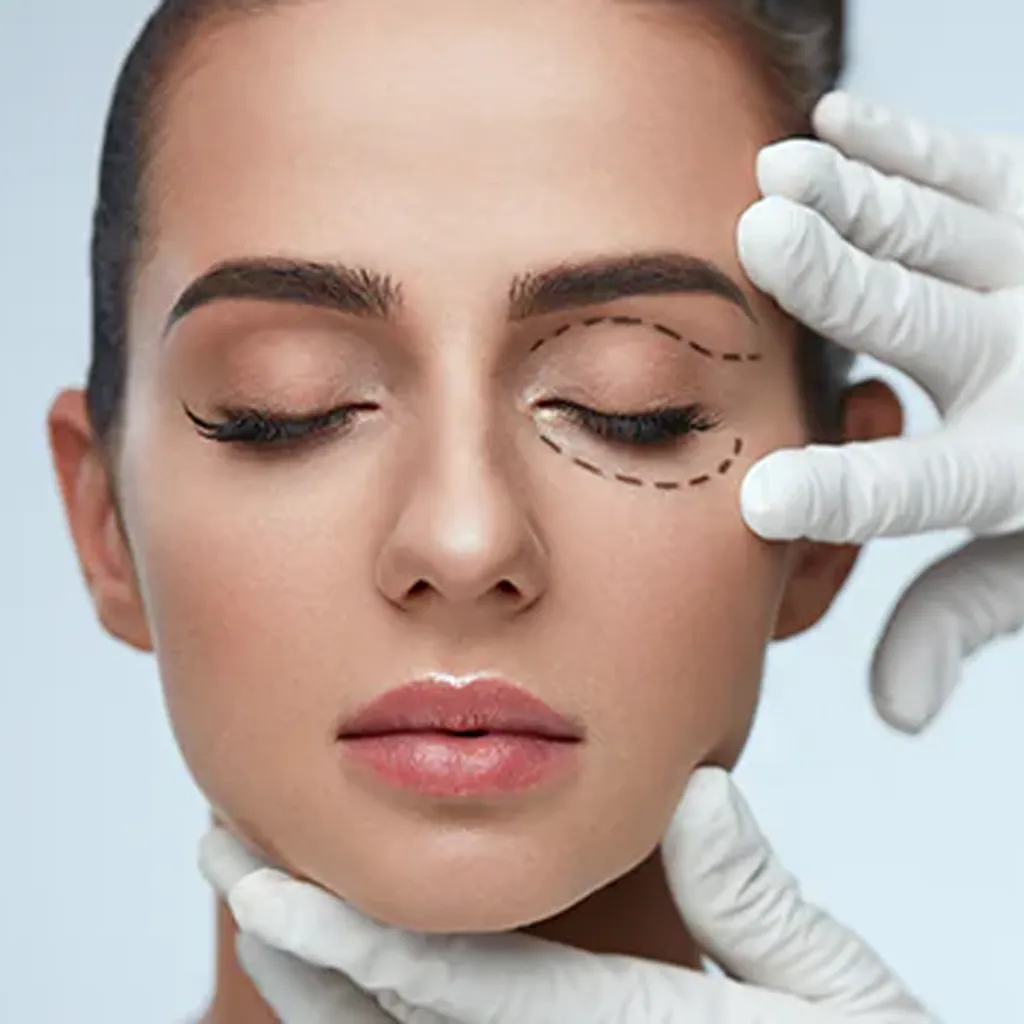 Oculoplasty and Reconstructive Eye Surgery