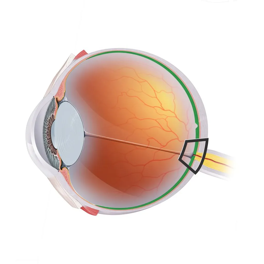 Retina & UVEA Treatment Services